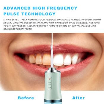 Teeth Cleaning Machine Water Flosser whitening Electric  - Random color